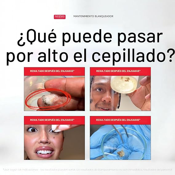 Enjuague Bucal Blanqueador y Antimanchas