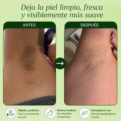 Aluna™: JIYU Pads Coreanos Aclarantes para axilas bonitas y suaves.